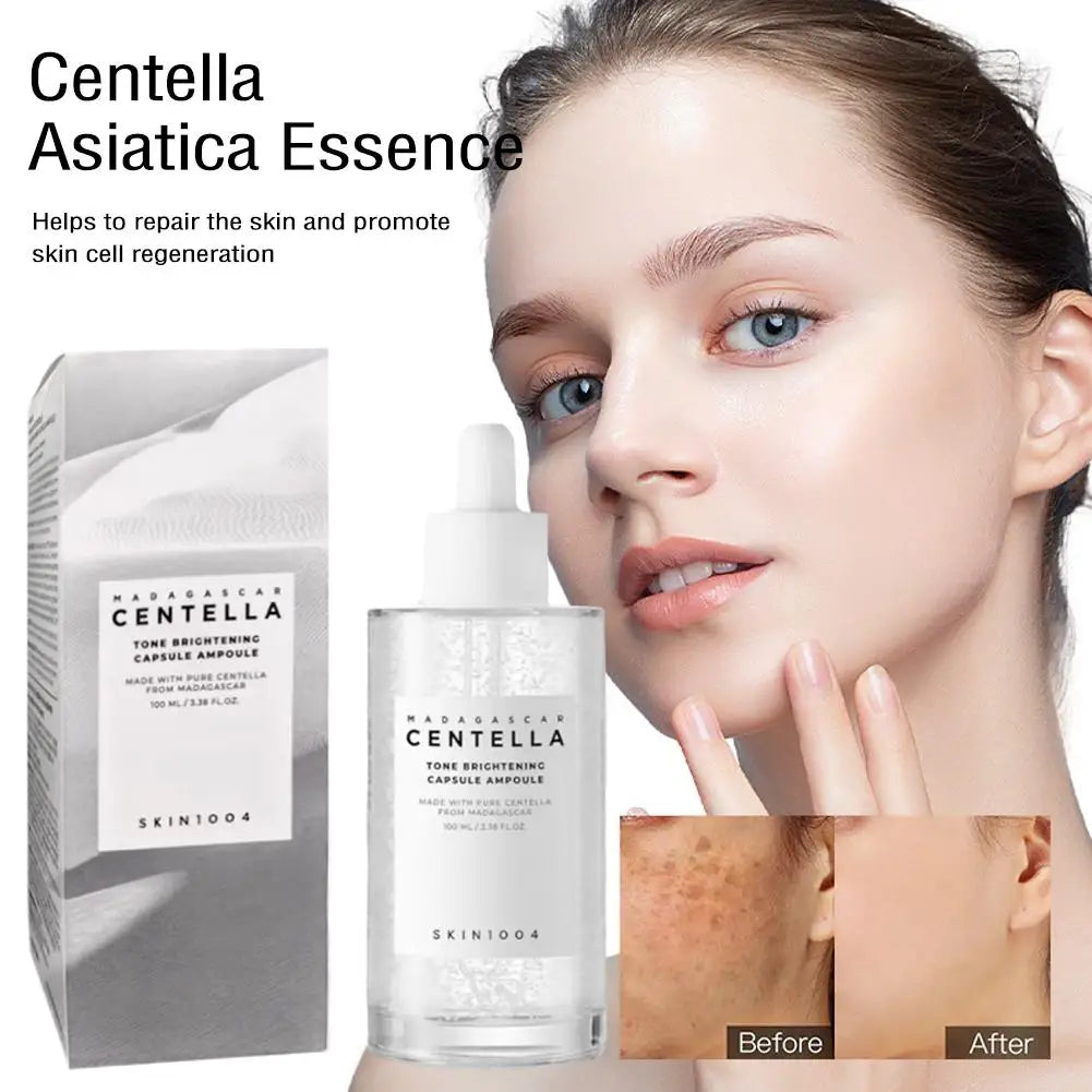 Centella Asiatica Serum & Korean Centella Toner Hellt die Haut auf, spendet intensive Feuchtigkeit, verfeinert Poren und unterstützt die Reduktion von Akne – die ideale Pflege für ein strahlendes Hautbild.