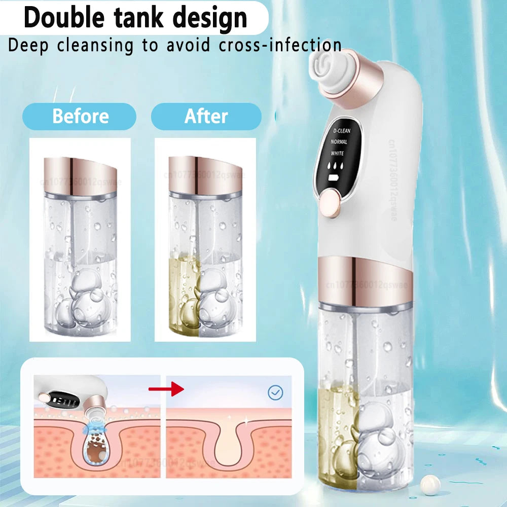 Mitesser-Entferner Pore Vacuum – Elektrischer Gesichtreiniger für Pickel, Akne & Mitesser – USB Wiederaufladbar, Wasserzyklus, Schwarze-Punkte-Entfernung