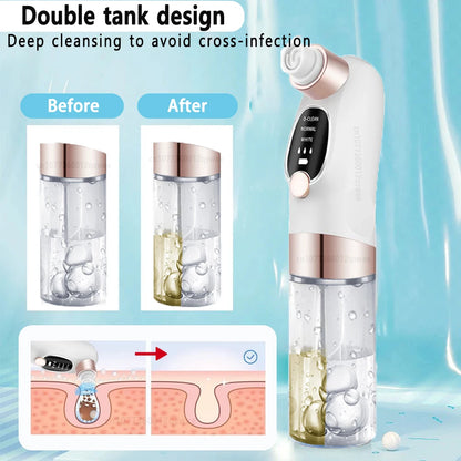 Mitesser-Entferner Pore Vacuum – Elektrischer Gesichtreiniger für Pickel, Akne & Mitesser – USB Wiederaufladbar, Wasserzyklus, Schwarze-Punkte-Entfernung