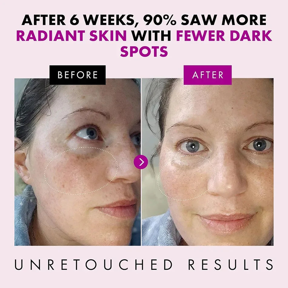 50g Kollagen Anti-Falten Straffende Gesichtscreme – Tiefe Feuchtigkeit, Reduziert feine Linien, Lifting, Anti-Aging & Aufhellung – Koreanische Gesichtspflege
