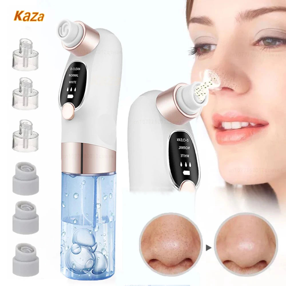 Mitesser-Entferner Pore Vacuum – Elektrischer Gesichtreiniger für Pickel, Akne & Mitesser – USB Wiederaufladbar, Wasserzyklus, Schwarze-Punkte-Entfernung