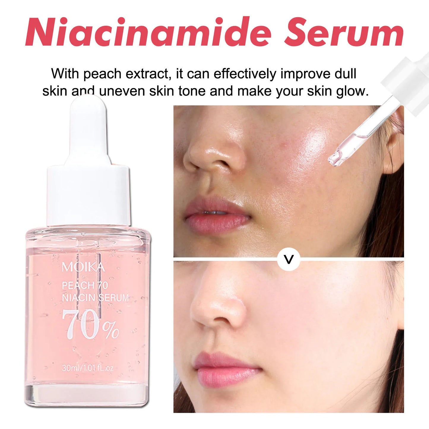 Niacinamid-Serum – Entfernt Dunkle Flecken, Reduziert Aknenarben & Hyperpigmentierung, Verfeinert Poren, Ebenmäßiger Hautton & Feuchtigkeitsspendende Gesichtspflege – Koreanische Skincare
