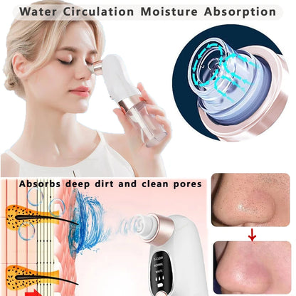 Mitesser-Entferner Pore Vacuum – Elektrischer Gesichtreiniger für Pickel, Akne & Mitesser – USB Wiederaufladbar, Wasserzyklus, Schwarze-Punkte-Entfernung